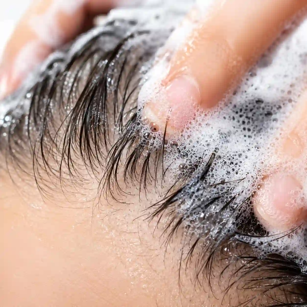 Close-up of scalp cleansing treatment performed on a professional head spa bed